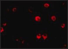 Anti-AES (ab2) antibody produced in rabbit affinity isolated antibody, buffered aqueous solution
