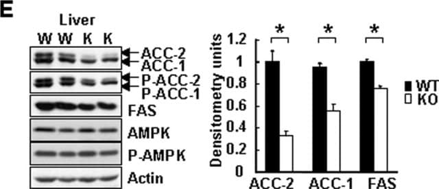 Anti-phospho-Acetyl CoA Carboxylase (Ser79) Antibody Upstate&#174;, from rabbit