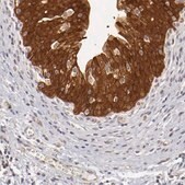 Anti-SH2D4A antibody produced in rabbit Ab1, Prestige Antibodies&#174; Powered by Atlas Antibodies, affinity isolated antibody, buffered aqueous glycerol solution