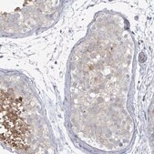 Anti-LILRA4 antibody produced in rabbit Prestige Antibodies&#174; Powered by Atlas Antibodies, affinity isolated antibody, buffered aqueous glycerol solution