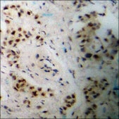 抗-磷酸-TIE2 (pTyr1108) 兔抗 affinity isolated antibody