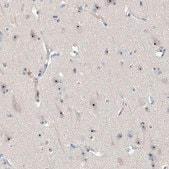 Anti-MPHOSPH10 antibody produced in rabbit Prestige Antibodies&#174; Powered by Atlas Antibodies, affinity isolated antibody, buffered aqueous glycerol solution