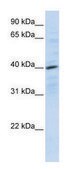 Anti-CXCR4 (N-terminal) antibody produced in rabbit affinity isolated antibody