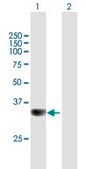 Anti-PPP6C antibody produced in mouse purified immunoglobulin, buffered aqueous solution