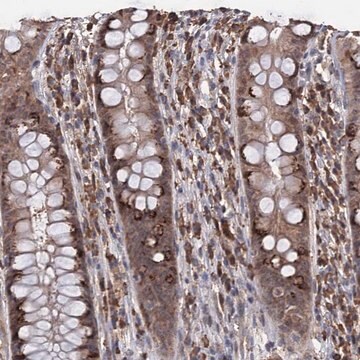 Anti-TBC1D12 antibody produced in rabbit Prestige Antibodies&#174; Powered by Atlas Antibodies, affinity isolated antibody, buffered aqueous glycerol solution