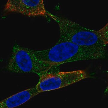 Anti-Adgra2 Antibody Produced In Rabbit Prestige Antibodies® Powered by Atlas Antibodies, affinity isolated antibody, buffered aqueous glycerol solution