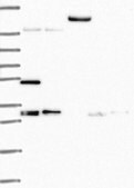 Anti-TACC1 antibody produced in rabbit Prestige Antibodies&#174; Powered by Atlas Antibodies, affinity isolated antibody, buffered aqueous glycerol solution
