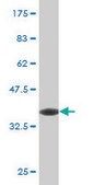 Monoclonal Anti-SNAI1 antibody produced in mouse clone 2G11, purified immunoglobulin, buffered aqueous solution