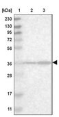 Anti-SPATC1L antibody produced in rabbit Prestige Antibodies® Powered by Atlas Antibodies, affinity isolated antibody, buffered aqueous glycerol solution, Ab2