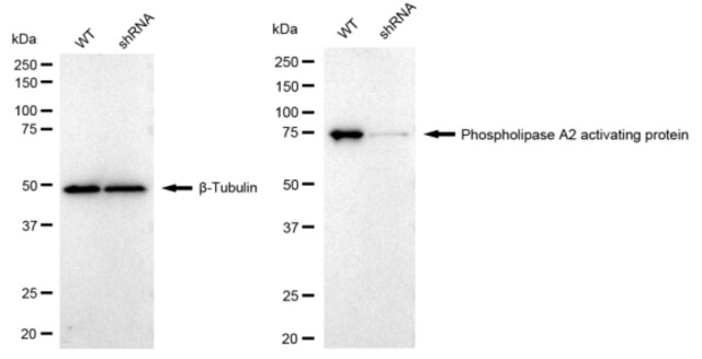 KD-Validated Anti Phospholipase A2 activating protein Antibody, clone 23GB2560, Rabbit Monoclonal clone 23GB2560, recombinant rabbit monoclonal, expressed in HEK293 cells