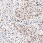 Anti-RBM3 antibody produced in rabbit Prestige Antibodies&#174; Powered by Atlas Antibodies, affinity isolated antibody, buffered aqueous glycerol solution