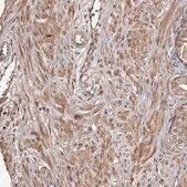 抗-CTGF 兔抗 Prestige Antibodies&#174; Powered by Atlas Antibodies, affinity isolated antibody, buffered aqueous glycerol solution, ab2