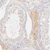 Anti-PLOD3 antibody produced in rabbit Prestige Antibodies&#174; Powered by Atlas Antibodies, affinity isolated antibody, buffered aqueous glycerol solution