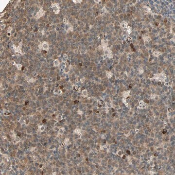 Anti-QSER1 antibody produced in rabbit Prestige Antibodies&#174; Powered by Atlas Antibodies, affinity isolated antibody, buffered aqueous glycerol solution