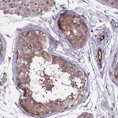 Anti-MAST2 antibody produced in rabbit Prestige Antibodies® Powered by Atlas Antibodies, affinity isolated antibody, buffered aqueous glycerol solution