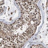 Anti-RRP1B antibody produced in rabbit Prestige Antibodies&#174; Powered by Atlas Antibodies, affinity isolated antibody, buffered aqueous glycerol solution, Ab1