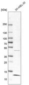 Anti-LAMTOR3 antibody produced in rabbit Prestige Antibodies® Powered by Atlas Antibodies, affinity isolated antibody, buffered aqueous glycerol solution