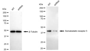 KD-Validated Anti Somatostatin Receptor 5 Antibody, clone 24GB2600, Rabbit Monoclonal clone 24GB2600, recombinant rabbit monoclonal, expressed in HEK293 cells