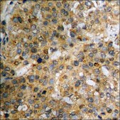 Anti-phospho-IkappaB-&#945; (pSer32/36) antibody produced in rabbit affinity isolated antibody