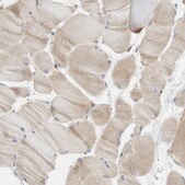 Anti-FGF1 antibody produced in rabbit Prestige Antibodies® Powered by Atlas Antibodies, affinity isolated antibody, buffered aqueous glycerol solution