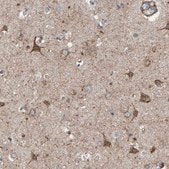 Anti-LRP1 antibody produced in rabbit Prestige Antibodies&#174; Powered by Atlas Antibodies, affinity isolated antibody, buffered aqueous glycerol solution