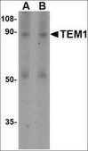 Anti-TEM1 (ab2) antibody produced in rabbit affinity isolated antibody, buffered aqueous solution