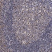 Anti-ARFGAP1 antibody produced in rabbit Prestige Antibodies&#174; Powered by Atlas Antibodies, affinity isolated antibody, buffered aqueous glycerol solution