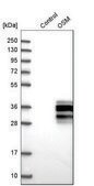 Anti-OSM antibody produced in rabbit Prestige Antibodies&#174; Powered by Atlas Antibodies, affinity isolated antibody, buffered aqueous glycerol solution