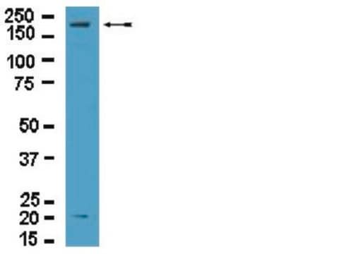 Anti-Dock2 Antibody from rabbit, purified by affinity chromatography