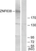 Anti-ZNF638 antibody produced in rabbit affinity isolated antibody