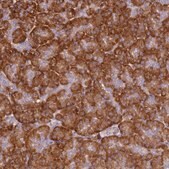 Anti-RPL13A antibody produced in rabbit Prestige Antibodies&#174; Powered by Atlas Antibodies, affinity isolated antibody, buffered aqueous glycerol solution