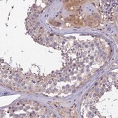 Anti-SLC39A13 antibody produced in rabbit Prestige Antibodies&#174; Powered by Atlas Antibodies, affinity isolated antibody, buffered aqueous glycerol solution