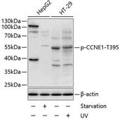 Anti-Phospho-CCNE1-T395 antibody produced in rabbit