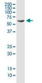 Monoclonal Anti-PDLIM5 antibody produced in mouse clone 3E11-F6, purified immunoglobulin, buffered aqueous solution