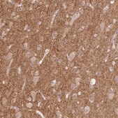 Anti-DBN1 antibody produced in rabbit Prestige Antibodies® Powered by Atlas Antibodies, affinity isolated antibody, buffered aqueous glycerol solution
