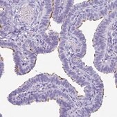 Anti-ODF3B antibody produced in rabbit Prestige Antibodies&#174; Powered by Atlas Antibodies, affinity isolated antibody, buffered aqueous glycerol solution