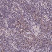 Anti-MT-ND3 antibody produced in rabbit Prestige Antibodies® Powered by Atlas Antibodies, affinity isolated antibody, buffered aqueous glycerol solution