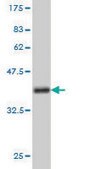 Monoclonal Anti-NVL antibody produced in mouse clone 3F6, purified immunoglobulin, buffered aqueous solution