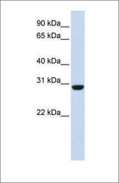 Anti-RCAN1 affinity isolated antibody
