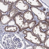 Anti-SLC4A4 antibody produced in rabbit Prestige Antibodies&#174; Powered by Atlas Antibodies, affinity isolated antibody, buffered aqueous glycerol solution