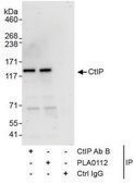 Rabbit anti-CtIP Antibody, Affinity Purified Powered by Bethyl Laboratories, Inc.