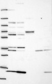 Anti-GYG1 antibody produced in rabbit Prestige Antibodies&#174; Powered by Atlas Antibodies, affinity isolated antibody, buffered aqueous glycerol solution