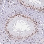 Anti-PBX2 antibody produced in rabbit Prestige Antibodies&#174; Powered by Atlas Antibodies, affinity isolated antibody, buffered aqueous glycerol solution