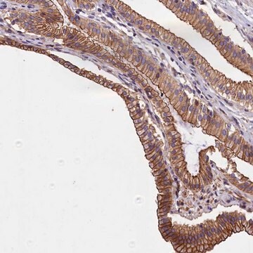 Anti-BLACE antibody produced in rabbit Prestige Antibodies&#174; Powered by Atlas Antibodies, affinity isolated antibody, buffered aqueous glycerol solution
