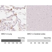 Anti-MRC1 antibody produced in rabbit Prestige Antibodies&#174; Powered by Atlas Antibodies, affinity isolated antibody, buffered aqueous glycerol solution