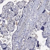 Anti-PTPN20 antibody produced in rabbit Prestige Antibodies&#174; Powered by Atlas Antibodies, affinity isolated antibody, buffered aqueous glycerol solution