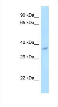 Anti-PNCK antibody produced in rabbit affinity isolated antibody