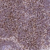 Anti-RB1 antibody produced in rabbit Prestige Antibodies® Powered by Atlas Antibodies, affinity isolated antibody, buffered aqueous glycerol solution