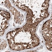 Anti-CEP85L antibody produced in rabbit Prestige Antibodies® Powered by Atlas Antibodies, affinity isolated antibody, buffered aqueous glycerol solution, ab1