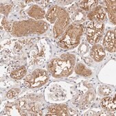 Anti-STAT5A antibody produced in rabbit Prestige Antibodies® Powered by Atlas Antibodies, affinity isolated antibody, buffered aqueous glycerol solution